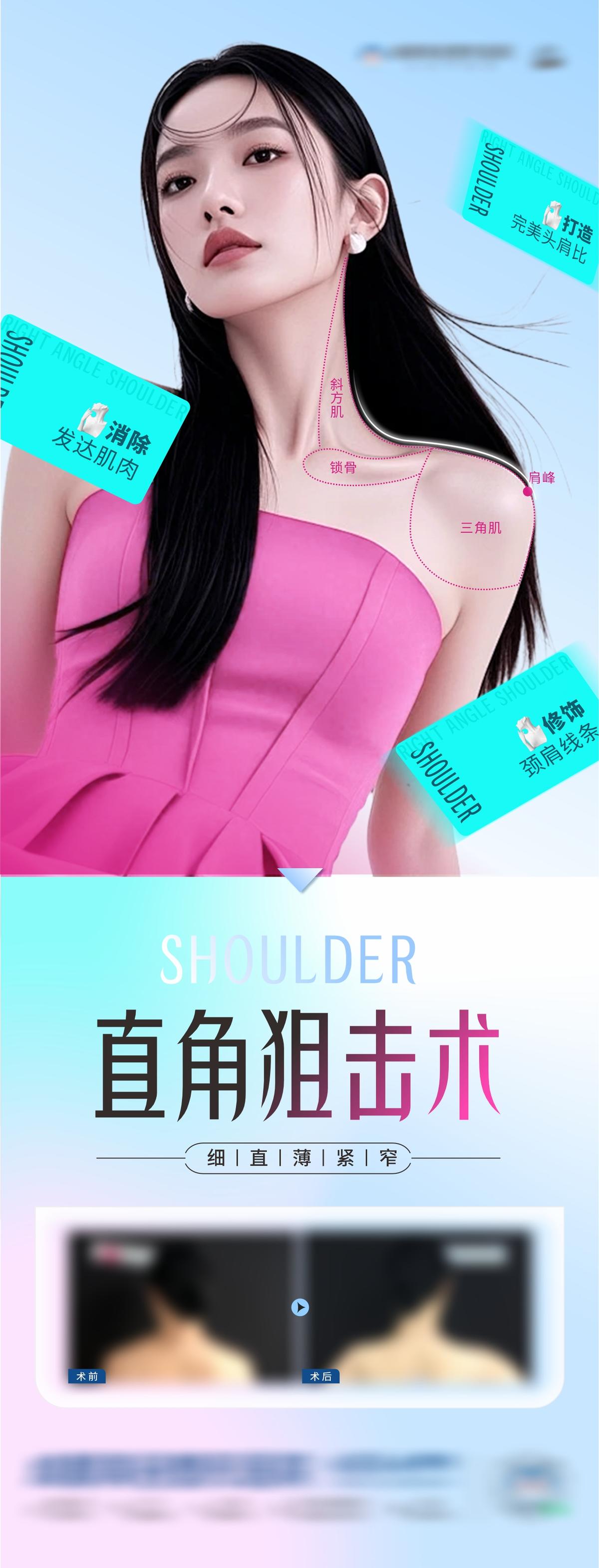 医美肉毒素形体案例直角肩创意海报