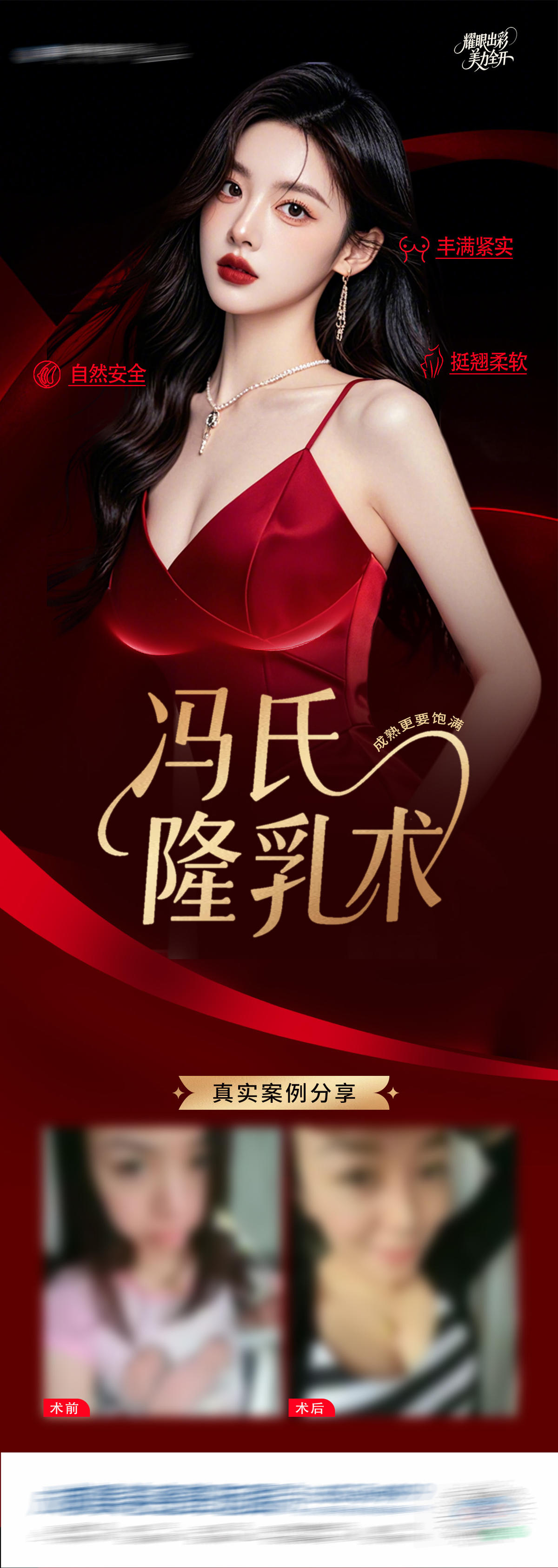 医美隆乳术案例创意长图海报