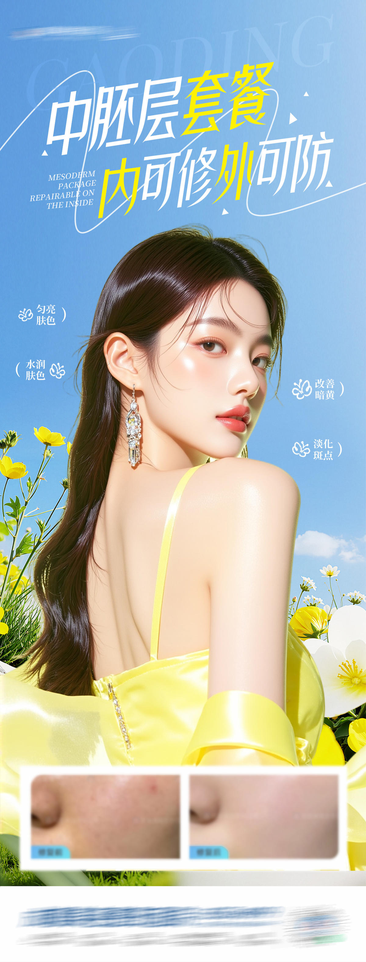 医美中胚层套餐案例创意海报