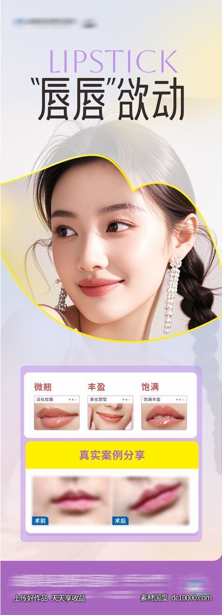 医美唇部塑形案例创意海报-源文件-素材国度dc10000.com