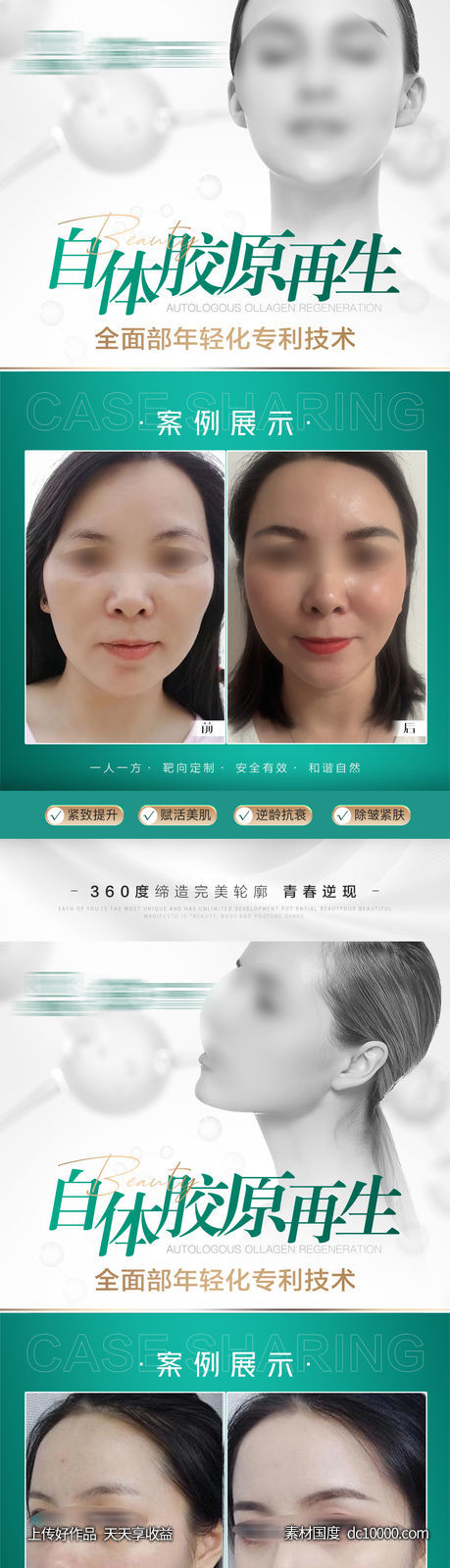 医美抗衰案例对比模板-源文件-素材国度dc10000.com