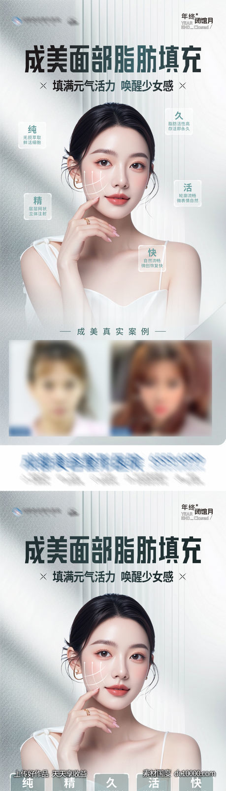 医美面部脂肪填充案例创意海报-源文件-素材国度dc10000.com