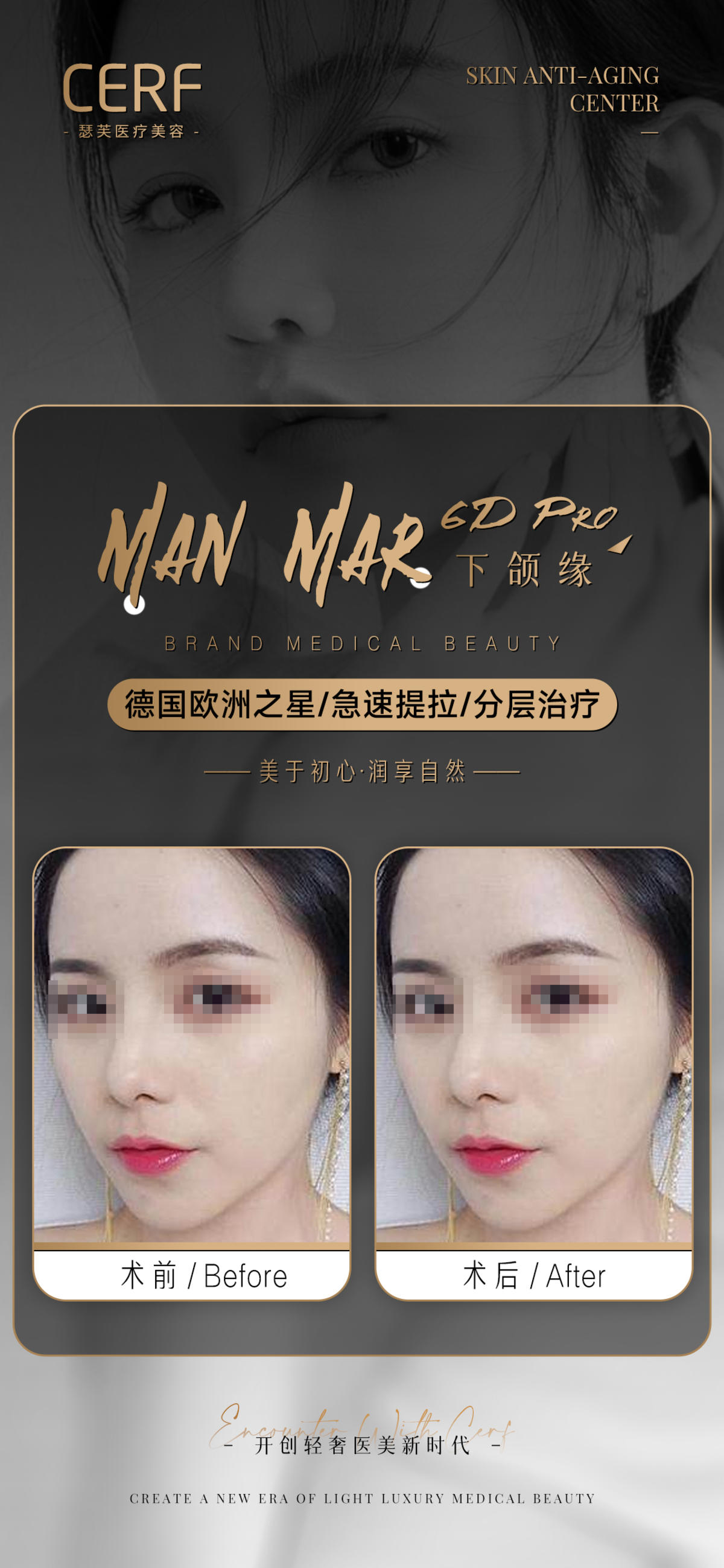医美术后前后对比照