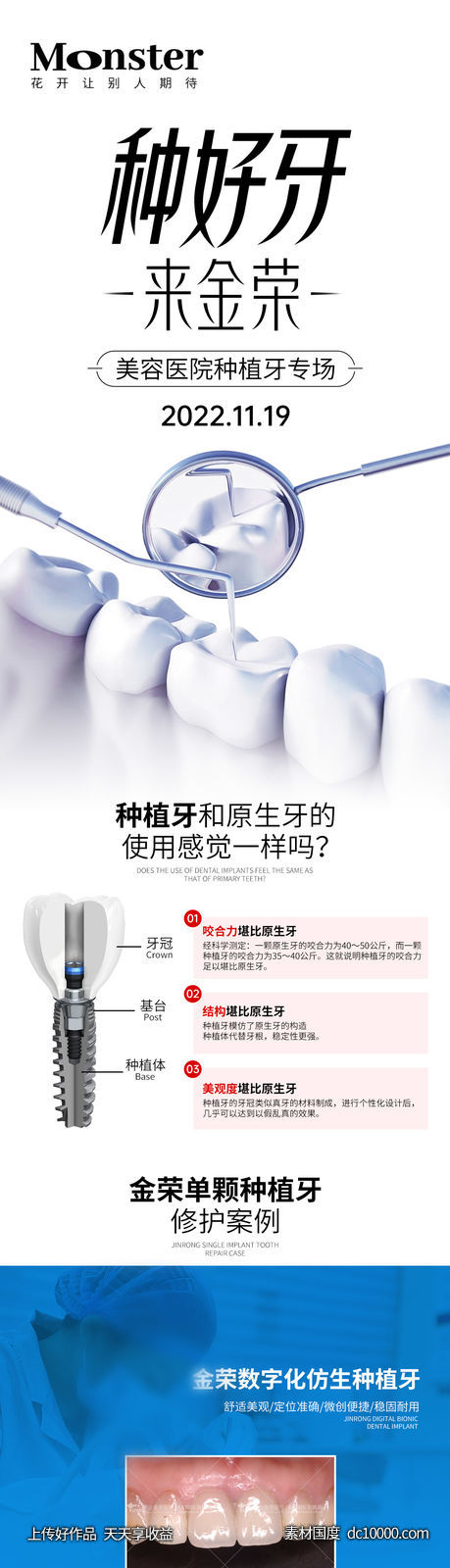 口腔种植牙专题-源文件-素材国度dc10000.com