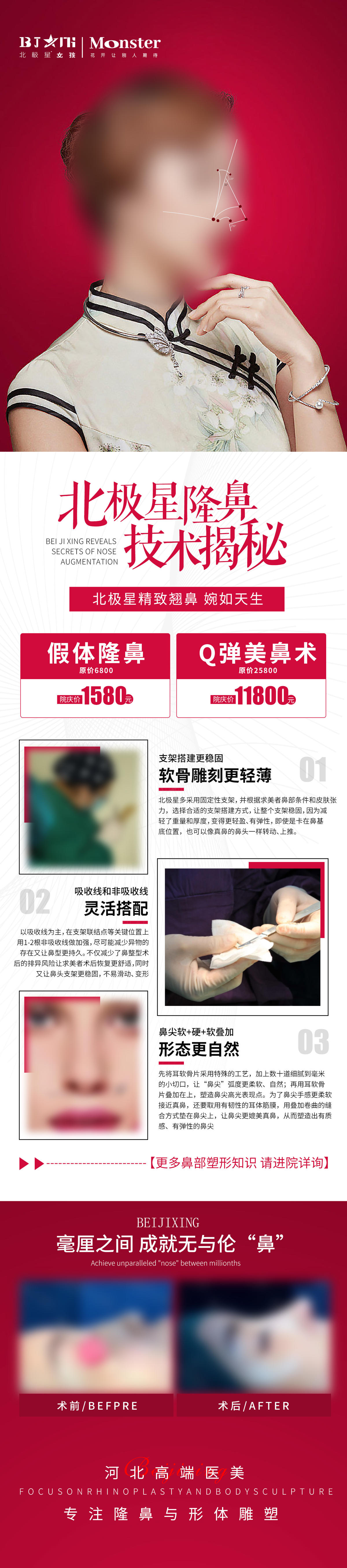 医美微整隆鼻技术科普