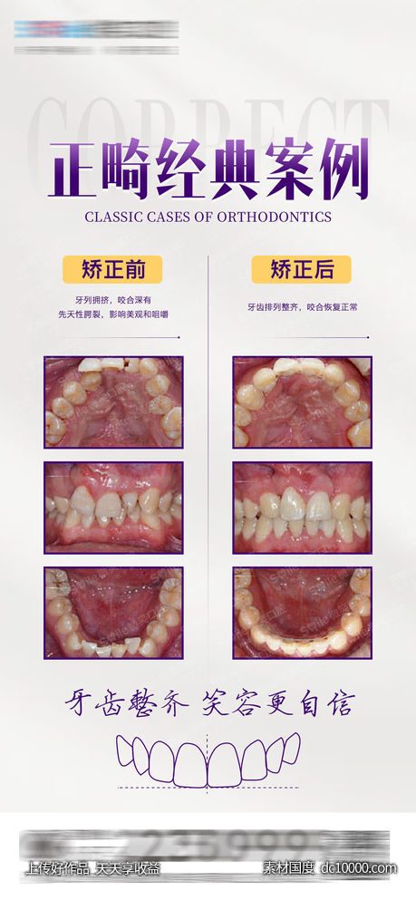 医美口腔正畸案例对比海报 - 源文件