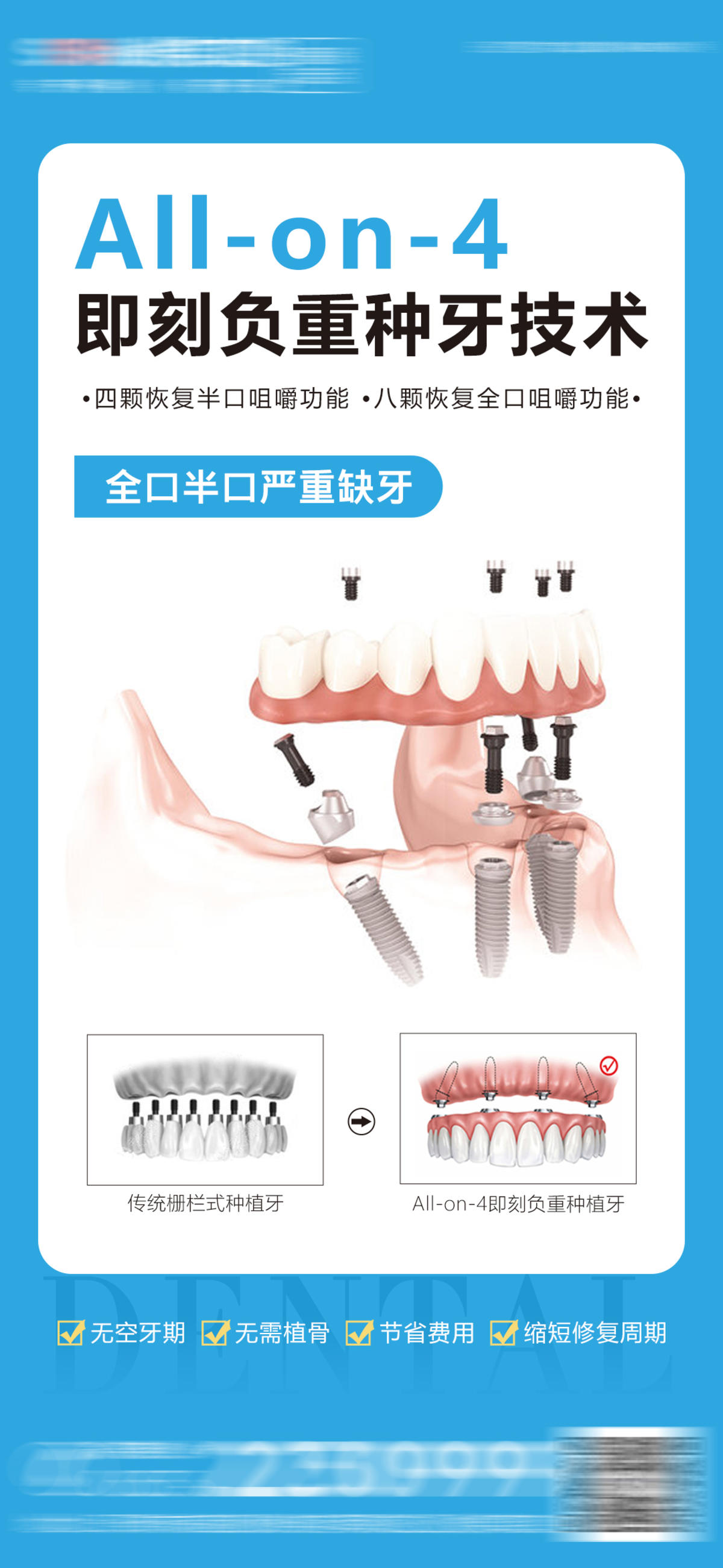 医美口腔种植牙海报