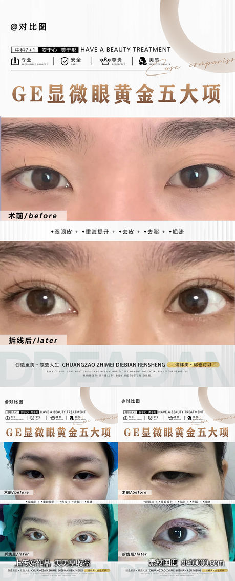 医美对比案列海报-源文件-素材国度dc10000.com