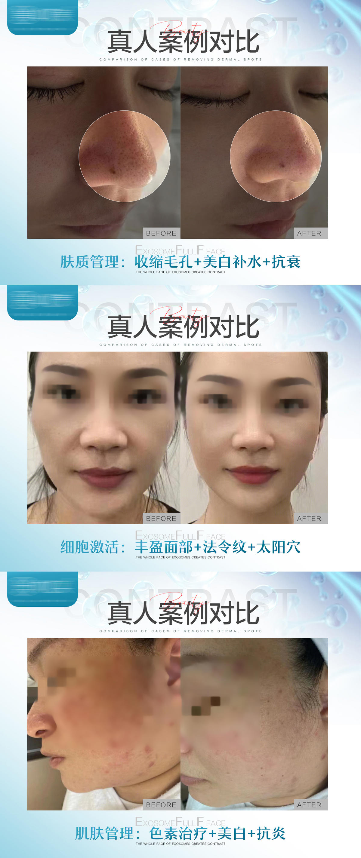 医美案例海报展示