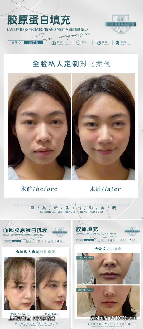 医美填充对比图 - 源文件