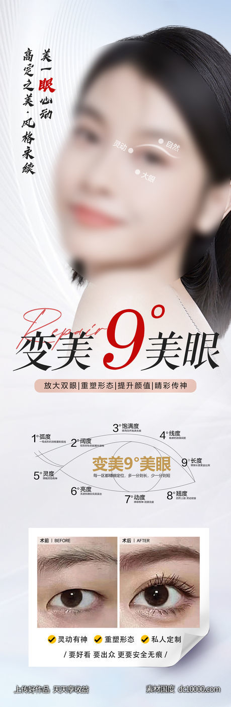 医美9°美眼案例对比 - 源文件