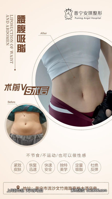 吸脂-源文件-素材国度dc10000.com