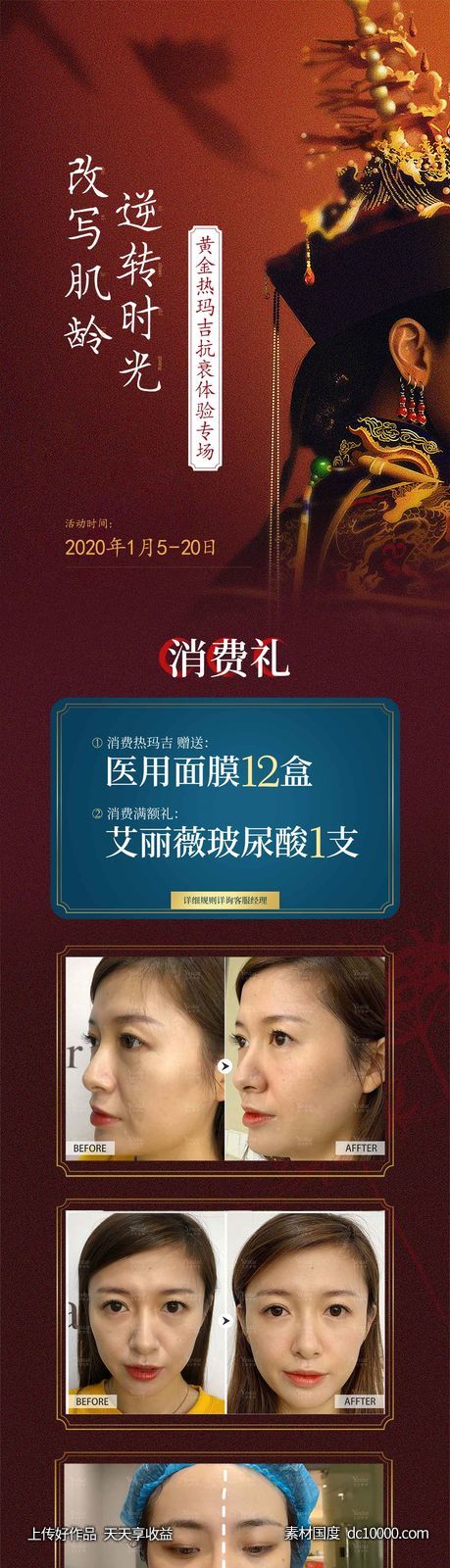热玛吉推广长图-源文件-素材国度dc10000.com
