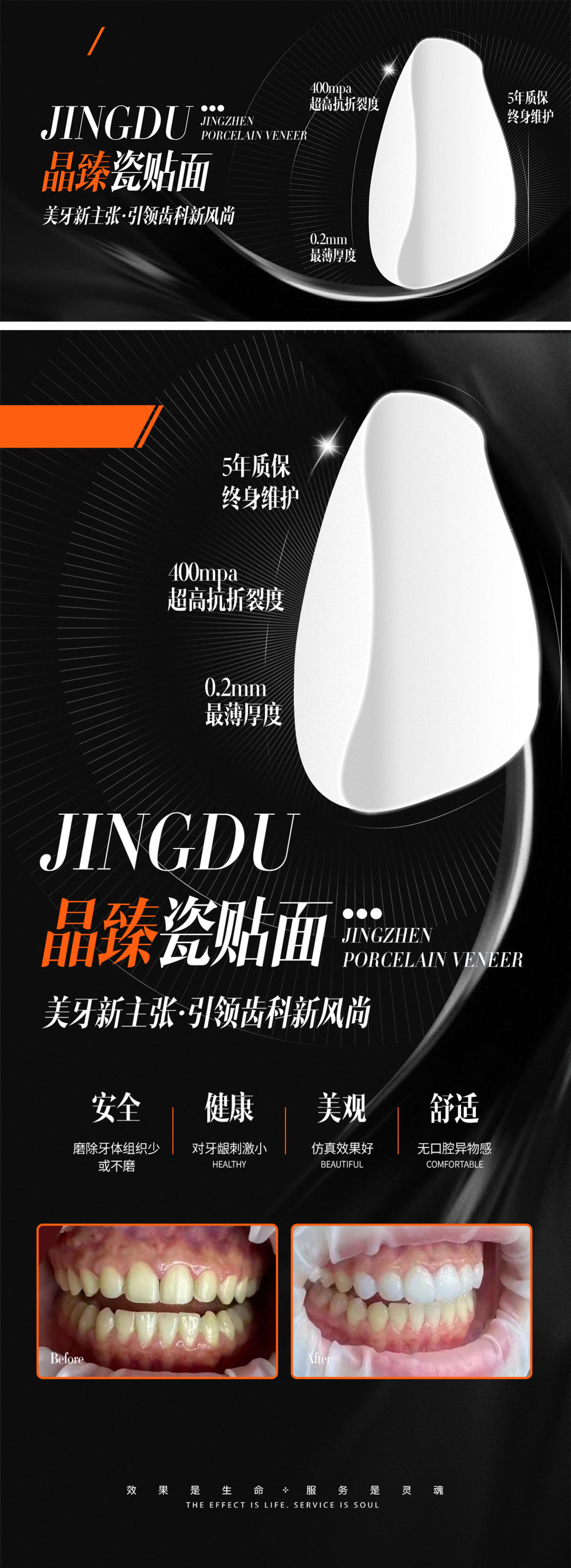 医美黑橙质感牙科贴面对比案例线上海报