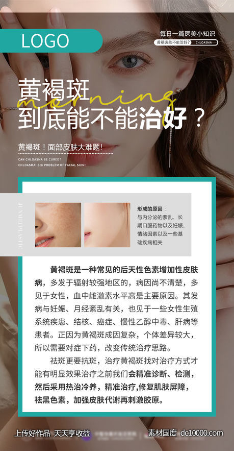 医美知识黄褐斑科普海报-源文件-素材国度dc10000.com