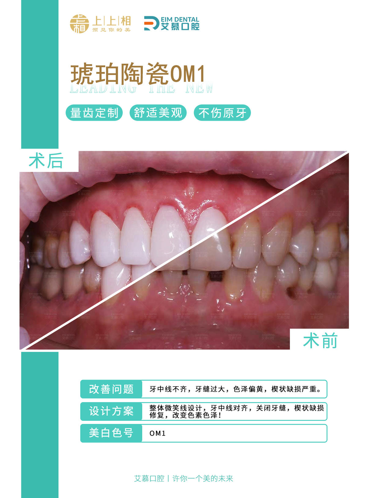 牙科 牙齿 医美
