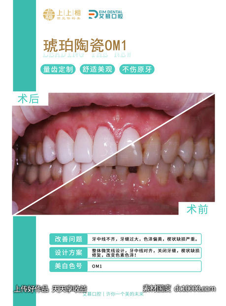 牙科 牙齿 医美-源文件-素材国度dc10000.com