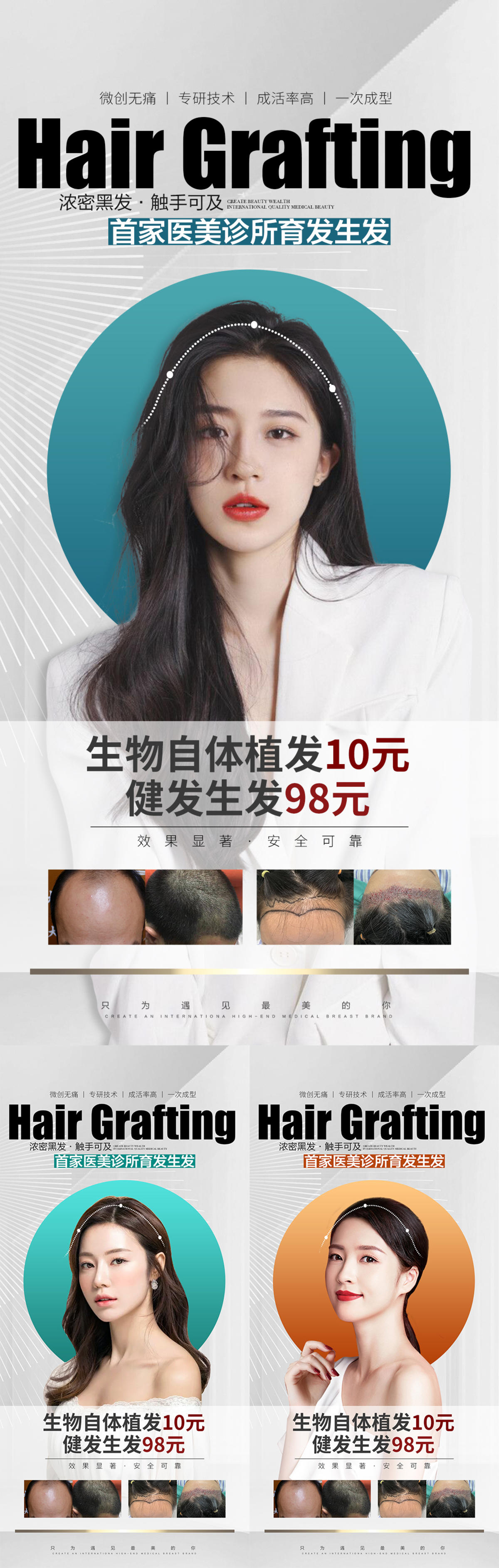 植发海报