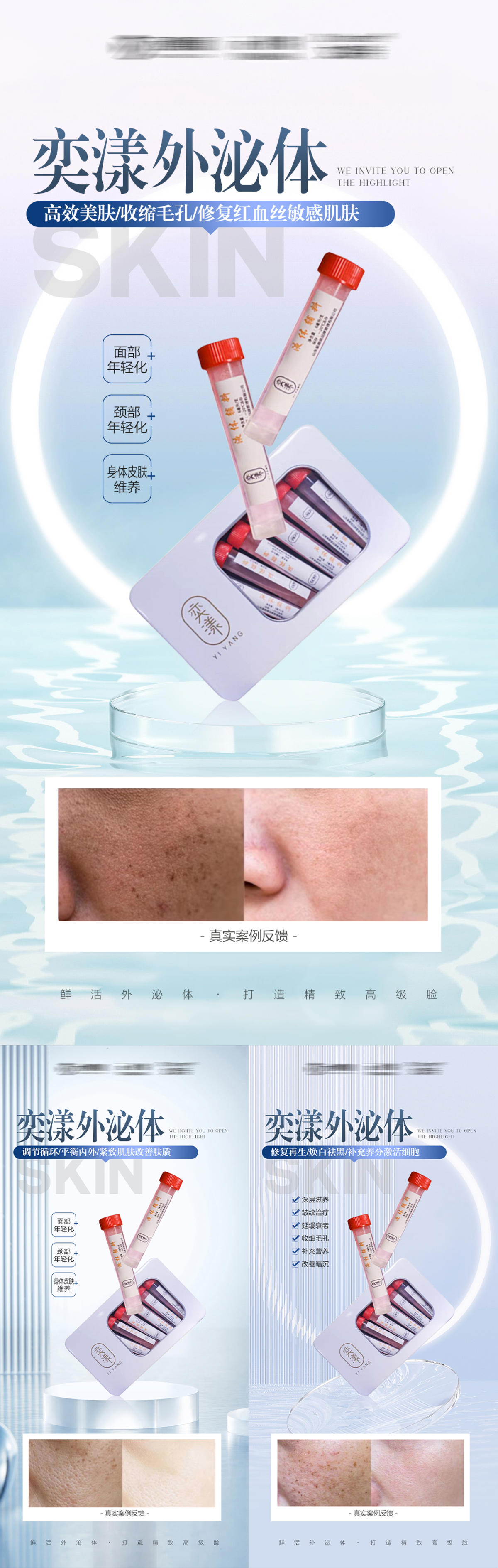 医美外泌体抗衰产品